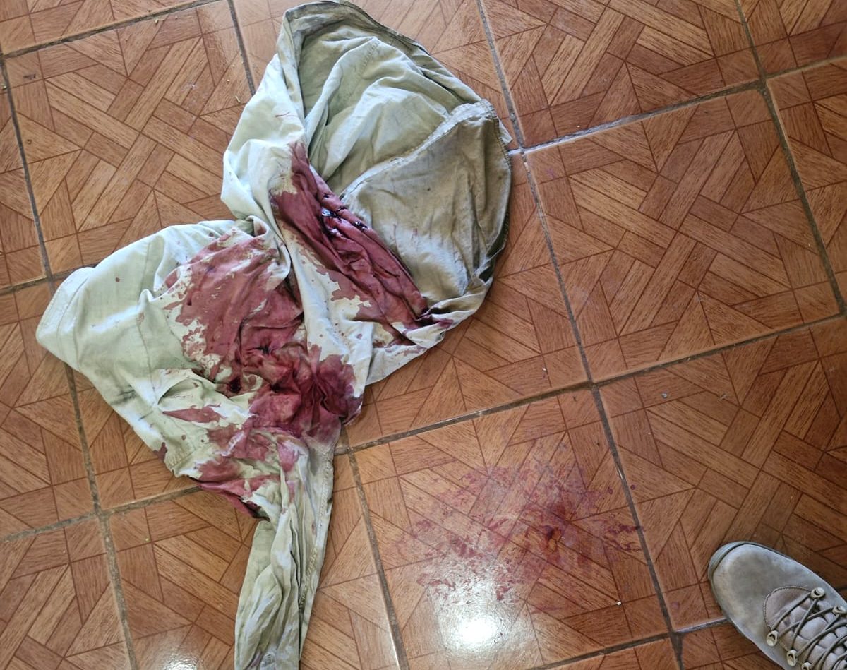 Morador é agredido e tem veículo roubado em assalto