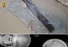 Homem é preso em flagrante por tentativa de feminicídio em São Carlos