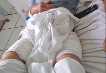Pescador é atacado por animal desconhecido em rio na região de Maximiliano de Almeida